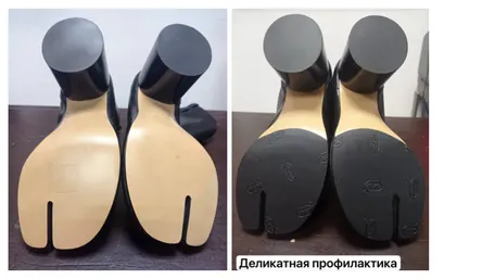 ПРОФИЛАКТИКА